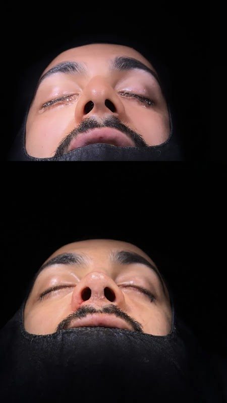 Dr. Barış Çokay - Estetik