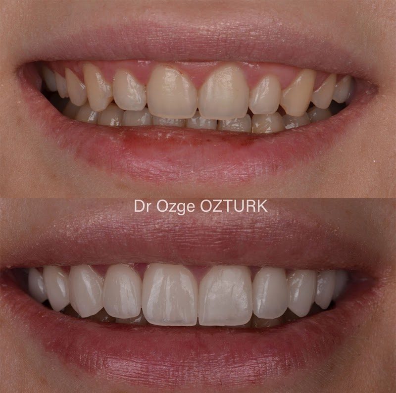 Dr. Özge Öztürk - Estetik