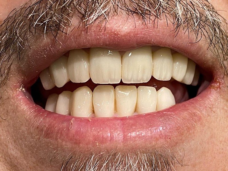 Dr. Ahmet Edle - Estetik