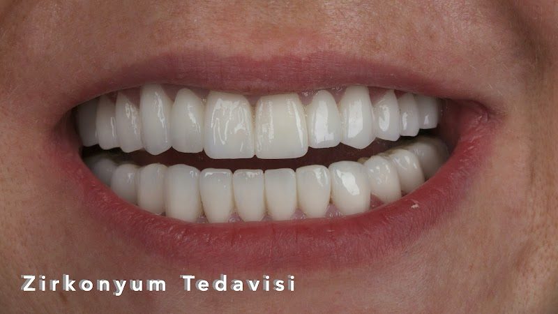 Diş Hek. Büşra Tekin
