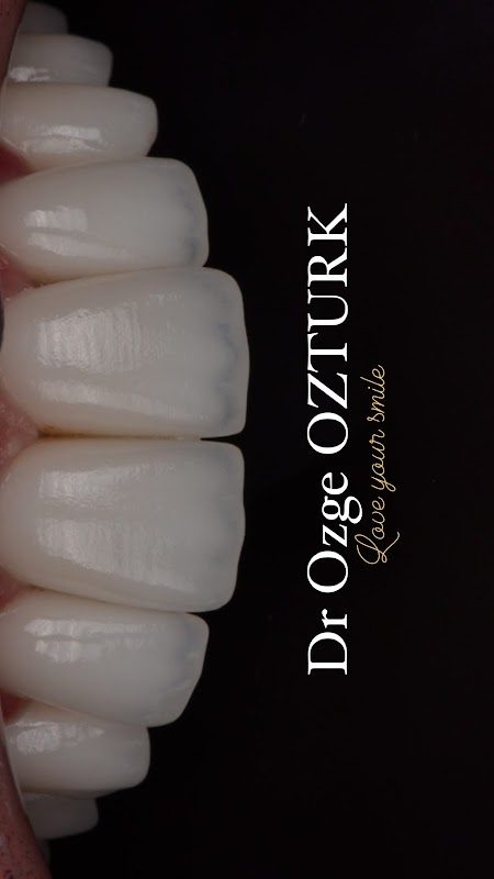Dr. Özge Öztürk - Estetik