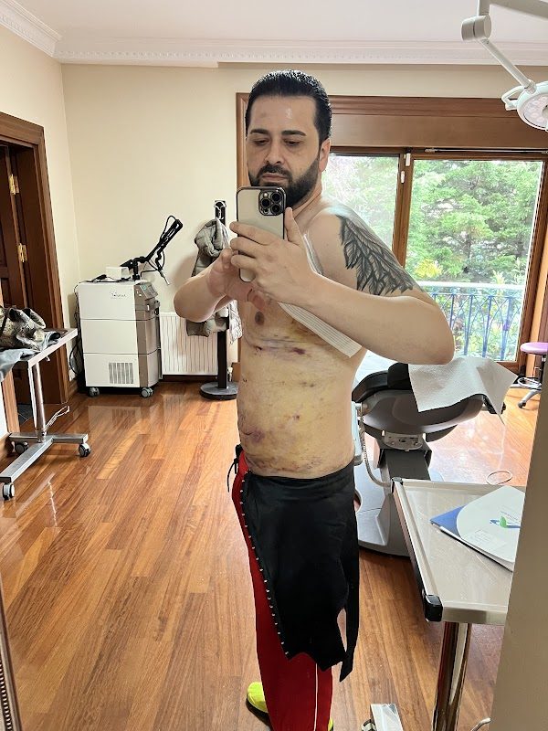 Dr. İbrahim Aşkar - Estetik