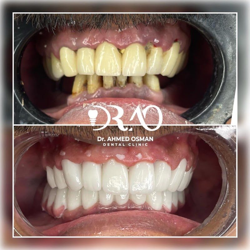 Dt. Ahmed Dentist - Estetik