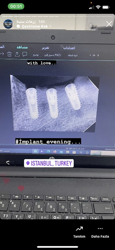 Dt. Ahmed Dentist - Estetik
